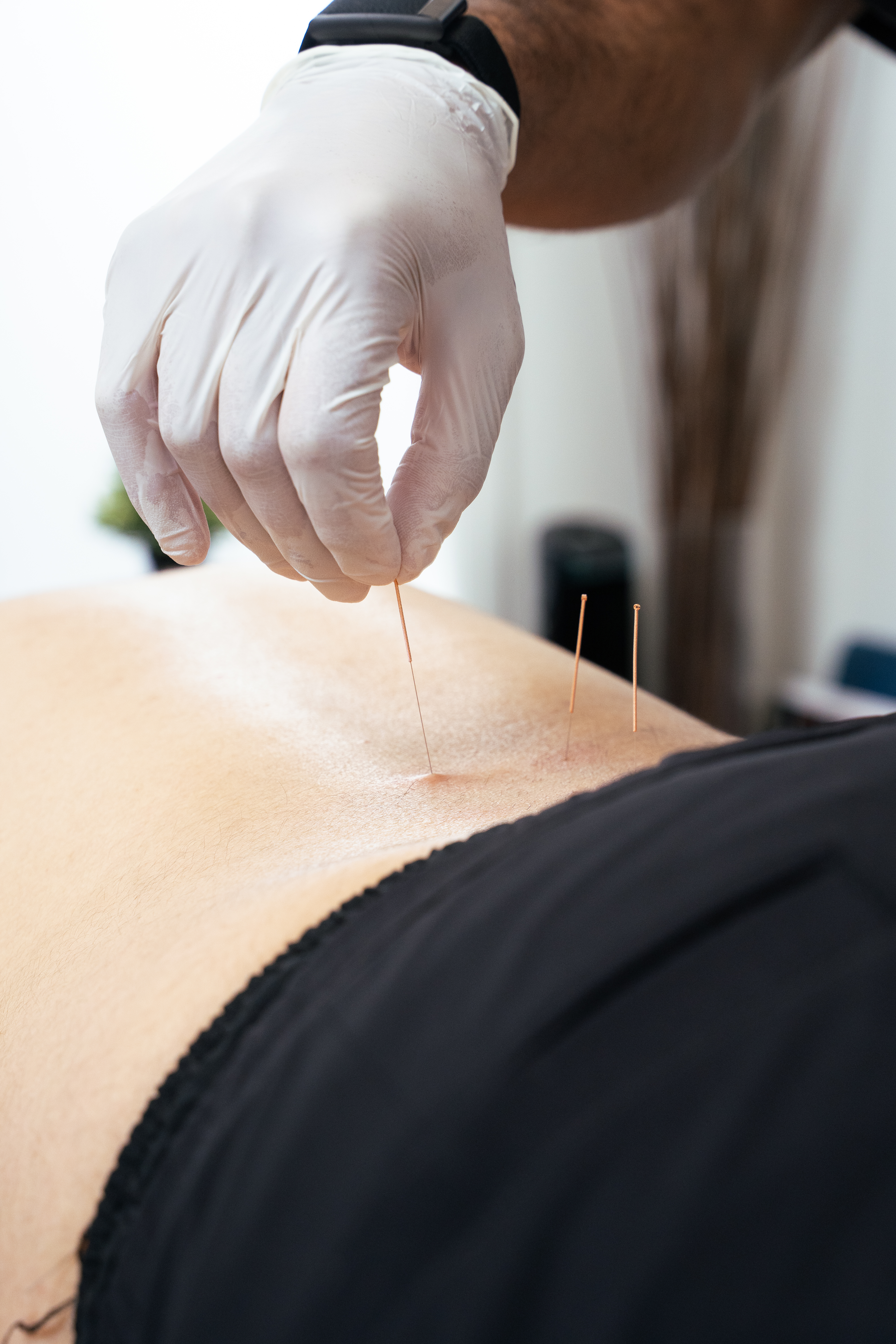 naturopathic medicine