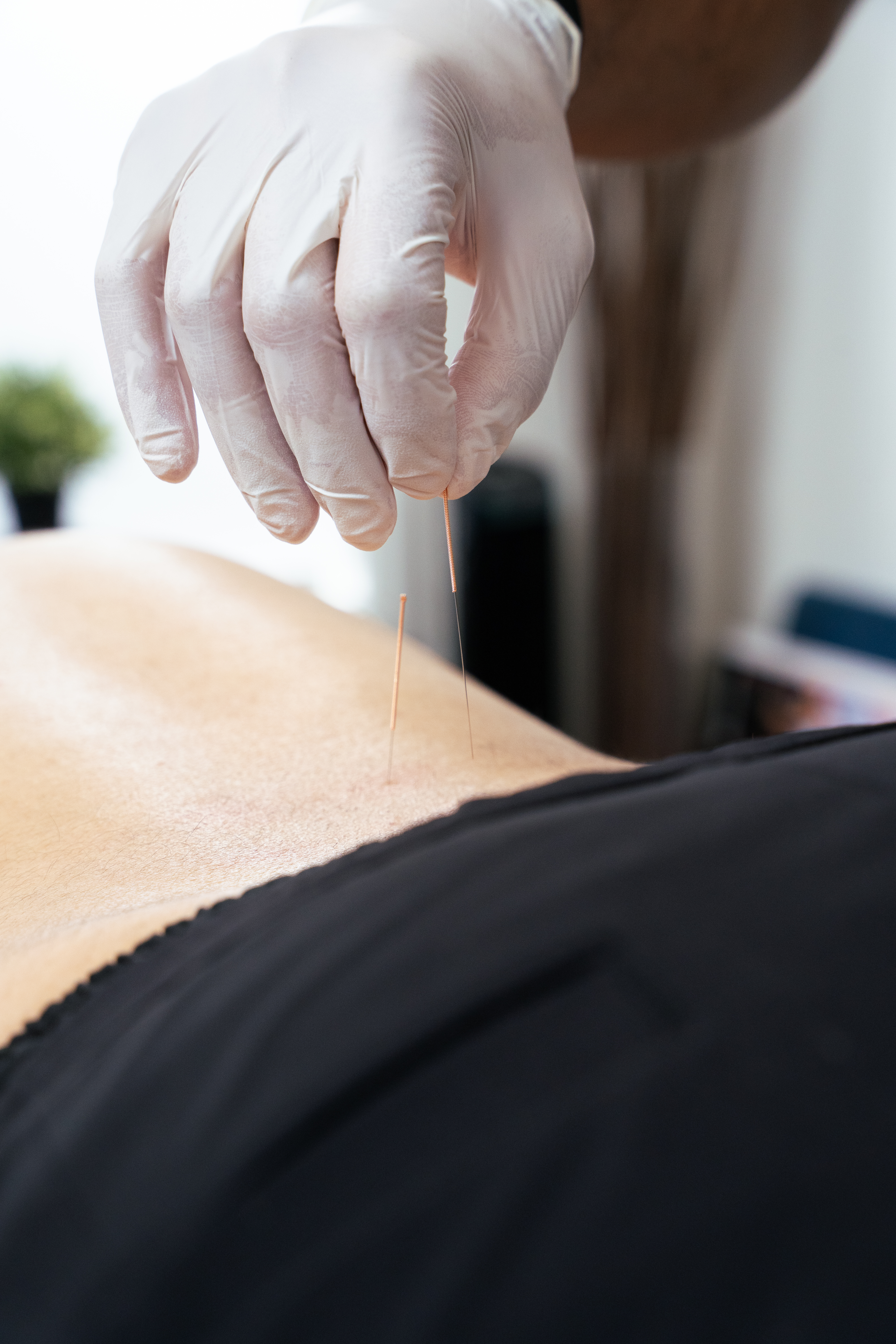 naturopathic medicine